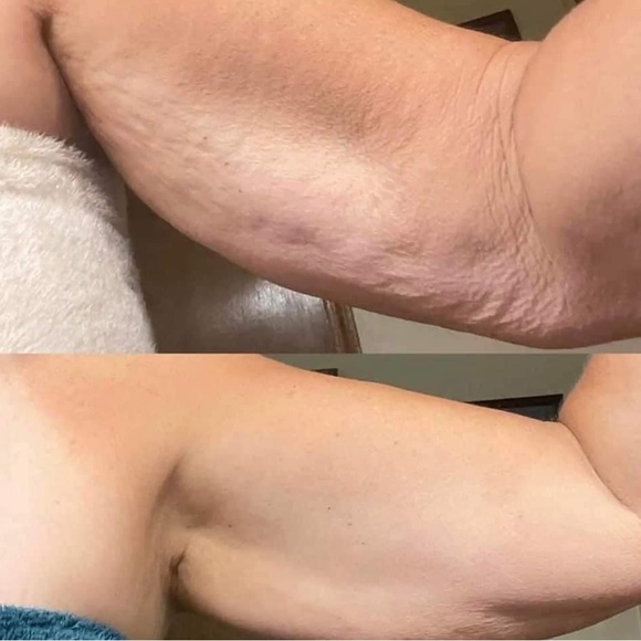 NUSKIN AGELOC HONEY & HIBISCUS CELLULITE LOTION 💋 Lot of 2 tubes - Picture 6 of 7